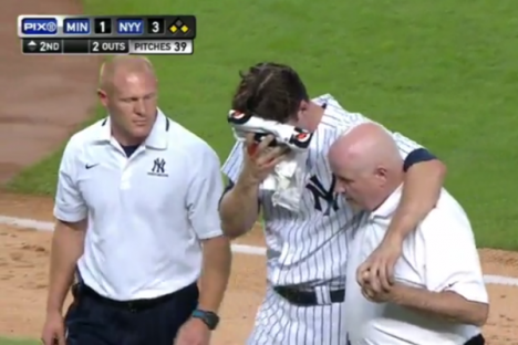 Vídeo: lesão no beisebol